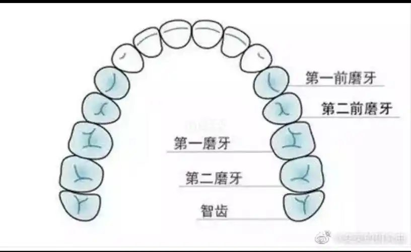 牙列拥挤正畸时除了拔牙还有别的选择吗?