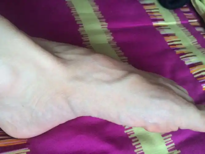 左脚脚背上有个鼓起的包一样,就是突起的骨头那儿.按压有点痛.