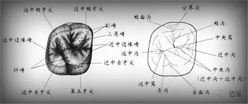 通过右上颌第一磨牙滴蜡塑形,同时进一步掌握第一磨牙的解剖形态.