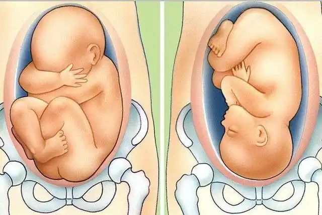 胎儿迟迟不入盆,不能顺利分娩?了解这些原因,孕妈做到心中有数