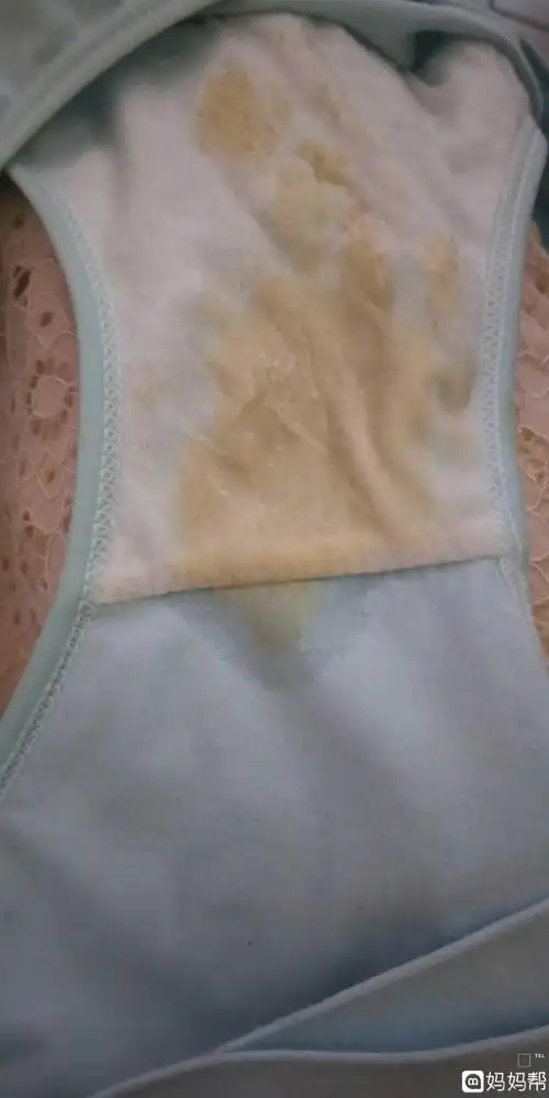 白带是黄的是怎么回事的简单介绍