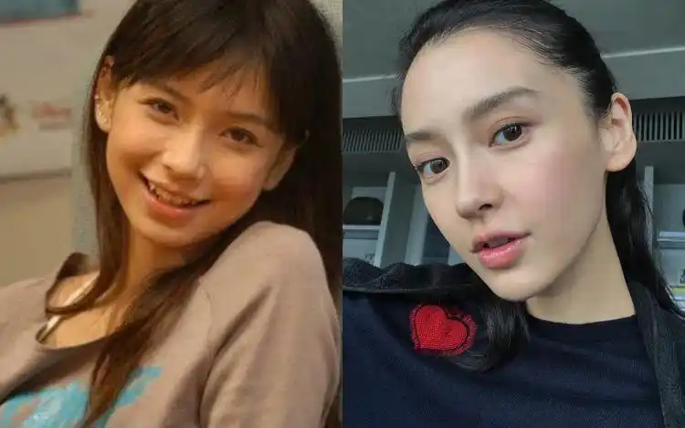 整容定减肥效果?女星下巴演变史!