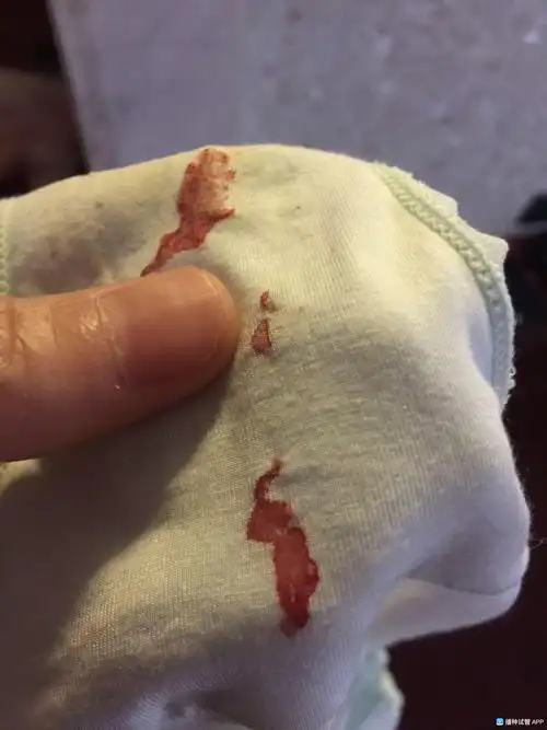 鲜胚移植第六天,刚发现内裤上有血,这个正常吗?