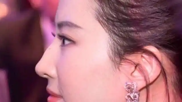 刘亦菲为何没把驼峰鼻做了