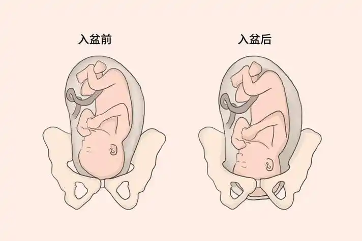 胎儿入盆图_胎儿入盆图片前后对比