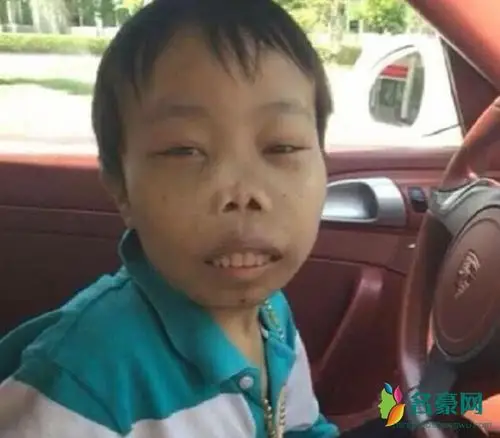 因"丑"成名的网红 最后一位连小朋友都喜欢他