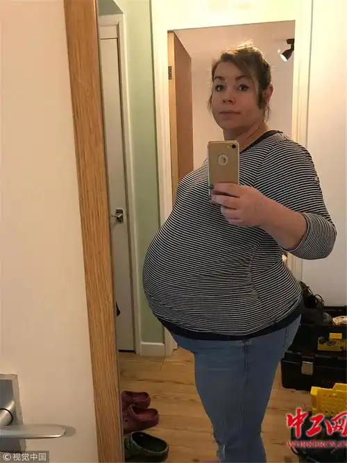 英国女子生神奇三胞胎