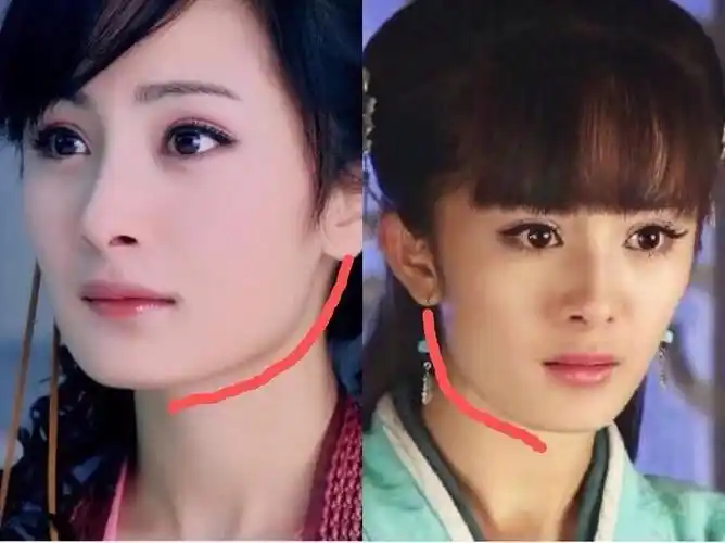 杨幂是削骨还是磨腮