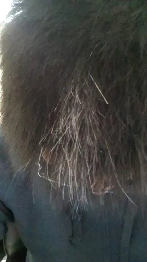 前头顶头发白了一撮是怎么回事?