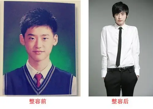 【图】李钟硕整容前后照片展示 整容前后照片太惊悚
