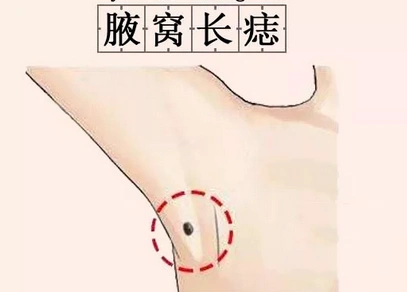 在痣相书上有记载,腋下长痣的人际关系好,异性缘强,主钱财逼身,代表的