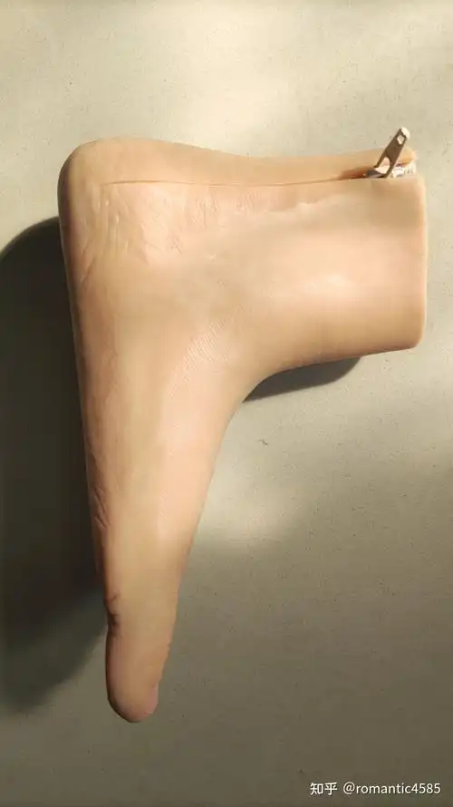 一例半足截肢患者制作硅胶拉链假肢的制作流程介绍