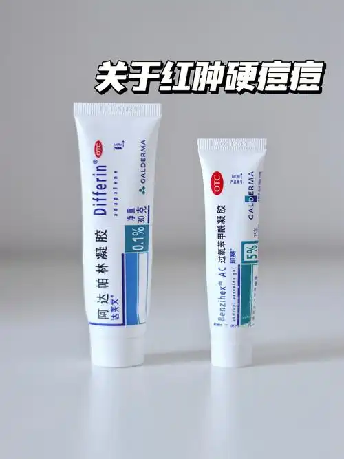 林凝胶②克林霉素/夫西地酸凝/甲硝唑 阿达帕林凝胶(白天这三种交替用