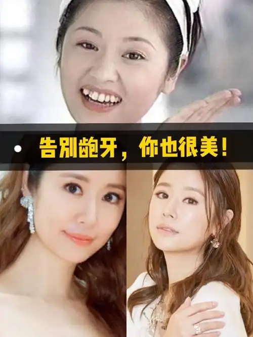 林心如也整过牙告别龅牙你也很美