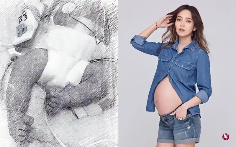 侯佩岑早产儿溶血症 加护病房抢救15天