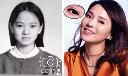 伊能静的双眼皮应该也偷偷割过了.