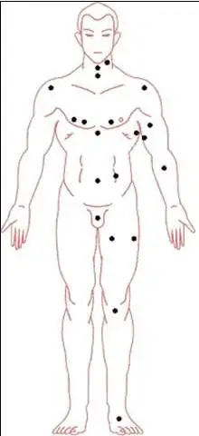 注:以下为 全身痣相图,并没相关图解解释,想要了解全身痣相图解可