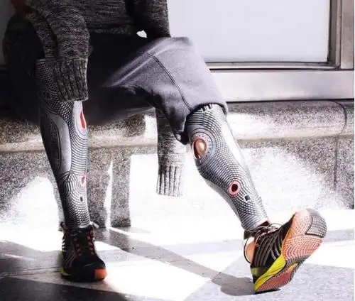 创造了现代小腿假肢的个性外壳