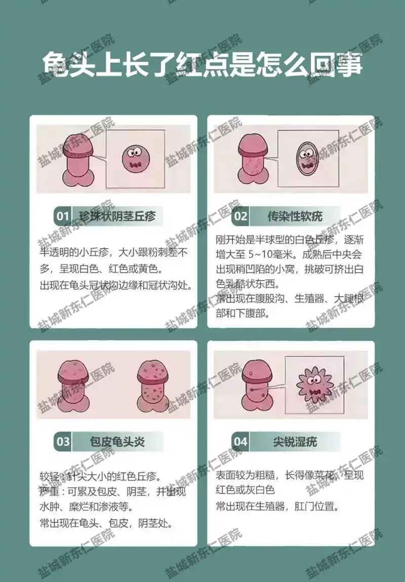 盐城男科# #盐城新东仁男科# #盐城龟头长红点
