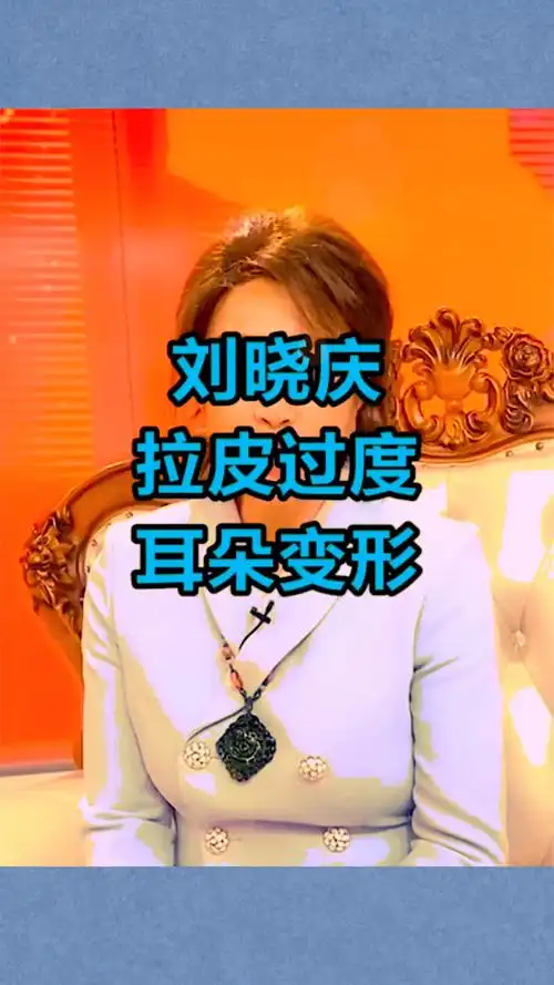 刘晓庆为永葆青春,整张脸拉皮过度,耳朵甚至直接变形了!