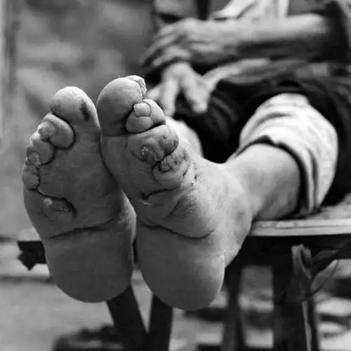 中国最后的小脚老人三寸金莲只有丈夫见过如今105几乎不洗脚