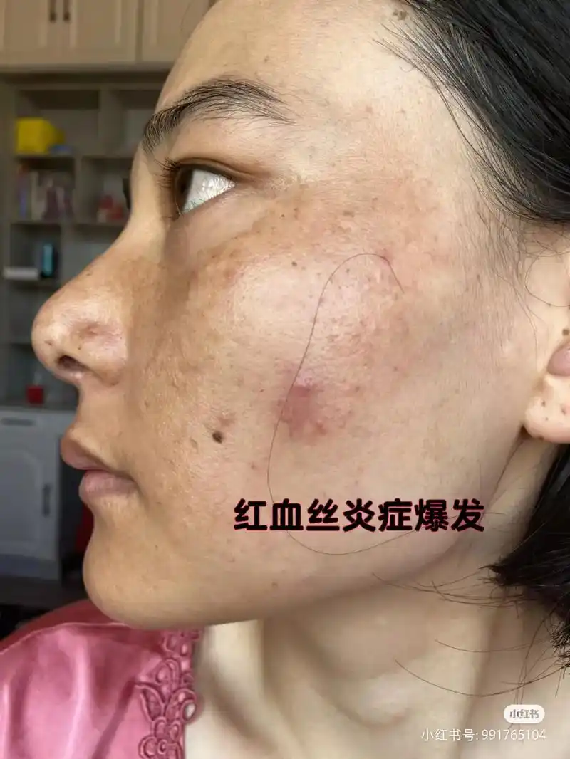 推给长斑的女孩们!自己的脸摸索出来的 - 抖音