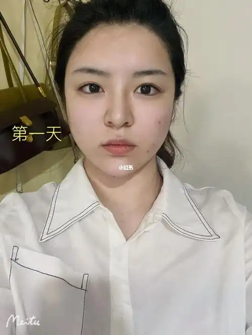 拔智齿第二天脸有点凹