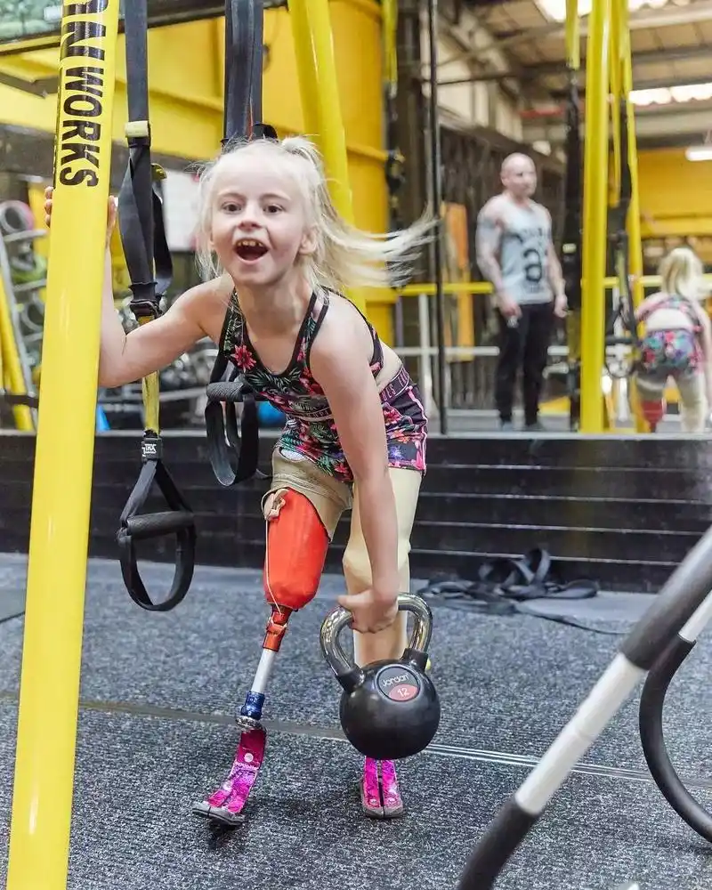 生来残缺,备受欺凌,她却做了一个这样的决定…|假肢|女孩|双腿_新浪