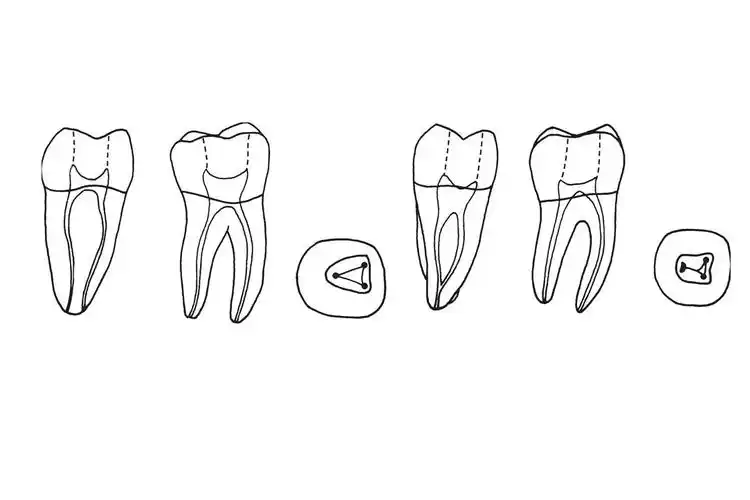 下颌第一磨牙牙一般有两个牙根,为近中,远中两个根,近中根形态较扁,此