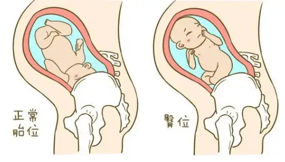 哪里好!胎儿打嗝是什么感觉"国内成熟"-第2张图片-奶酪博客