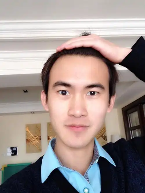 我发际线比较高,请问设计什么发型更适合我?(附上图片)