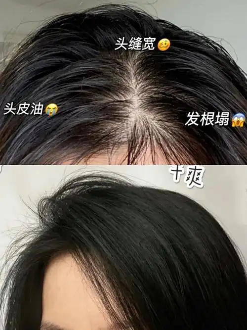 头发超级油每天都要洗头有没有好用到飞起的控油洗发水推荐