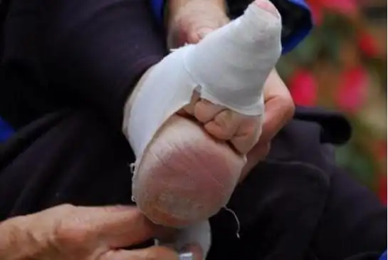 三寸金莲古代裹脚不同大小的脚还分等级