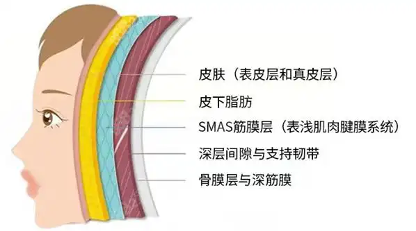 柳民熙院长擅长3d童颜术:手术是筋膜层提升的同时将颧骨脂肪进行固定