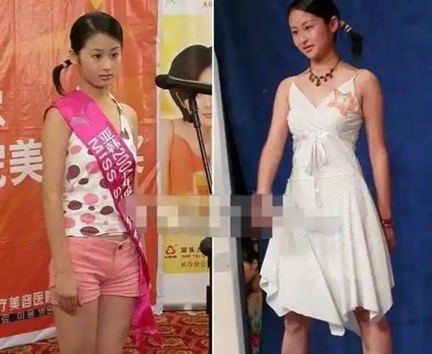 颖儿出道前照片曝光150斤婴儿肥单眼皮很可爱