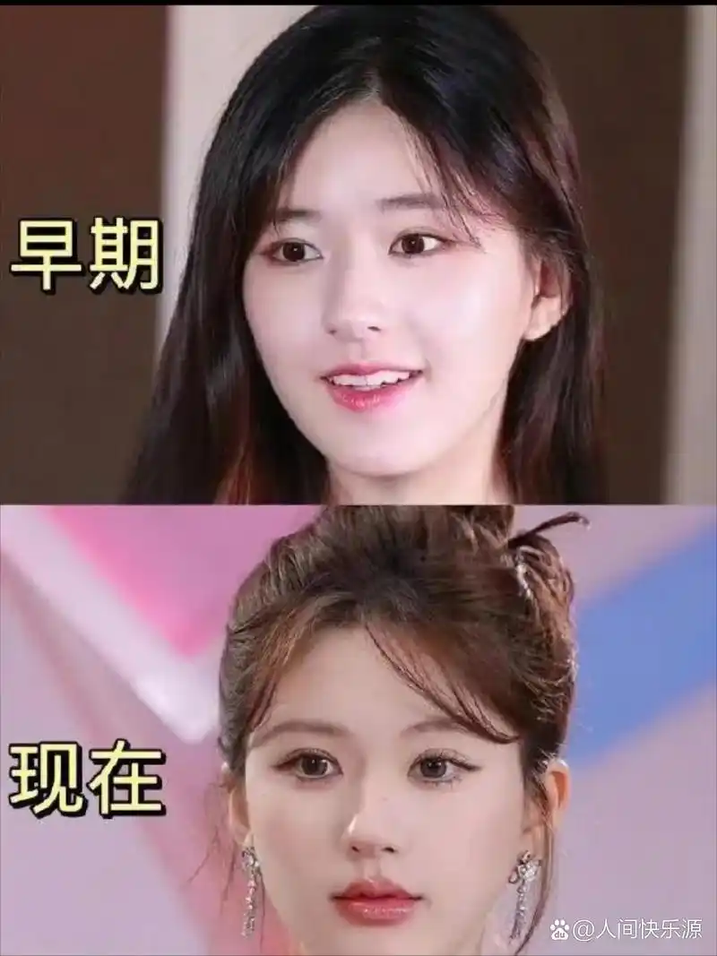 赵露思整容了? 有粉丝出来解释一下吗? 没看出来91#星驾到
