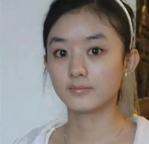 娱乐圈扒皮系列——第三期,赵丽颖整容史