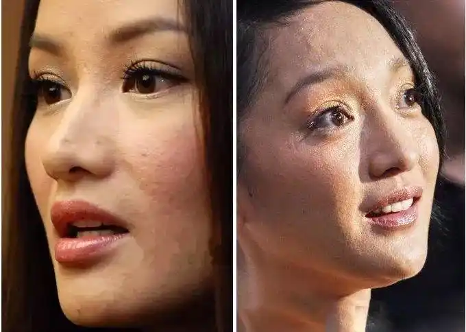 毛孔粗大和黑头的问题,    连大牌女明星也hold不