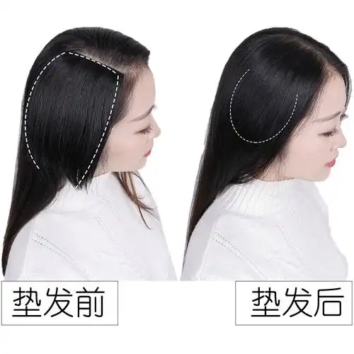 眉俏垫发片补全真发女男假发接垫发根隐形高头顶两侧蓬松卷直长短