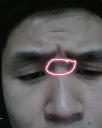 山根在面相学当中代表夫妻座,这里是夫妻关系的位置,如果这里有横纹的