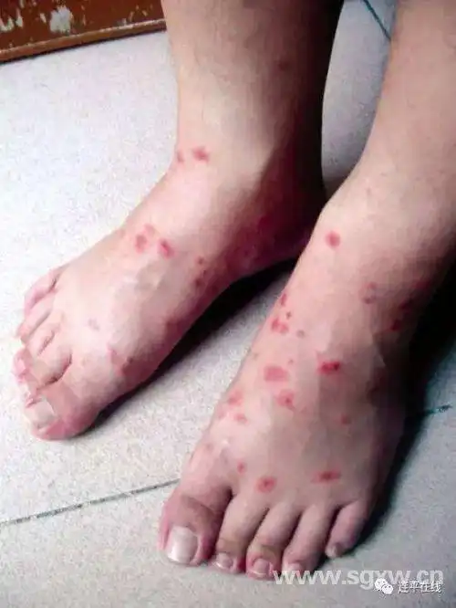 红火蚁正在入侵我们的家园——韶关红火蚁问题调查