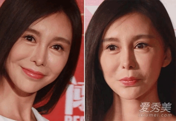 郑爽巩新亮汪东城 男女明星整容变"蛇精脸"_word文档在线阅读与下载_