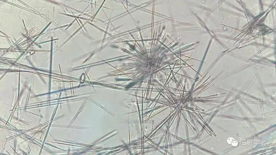 尿酸结晶的形态