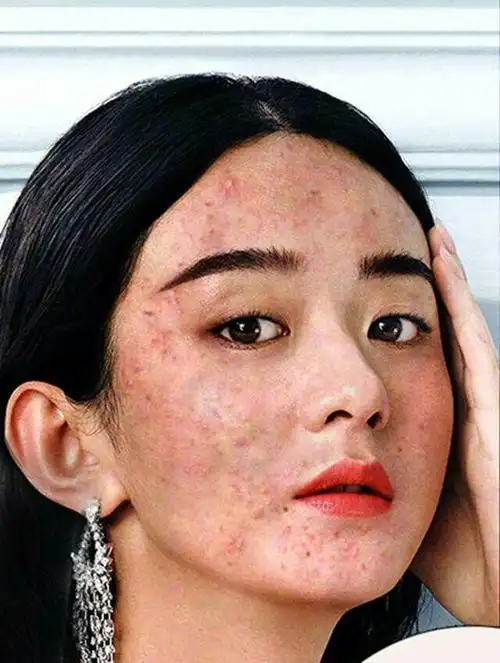 女星卸妆实在是太丑了!迪丽热巴上榜!