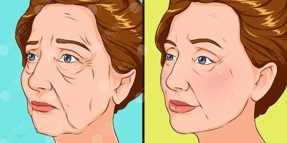 脸上皮肤松弛下垂还能恢复吗有什么办法解决脸上皮肤松弛下垂