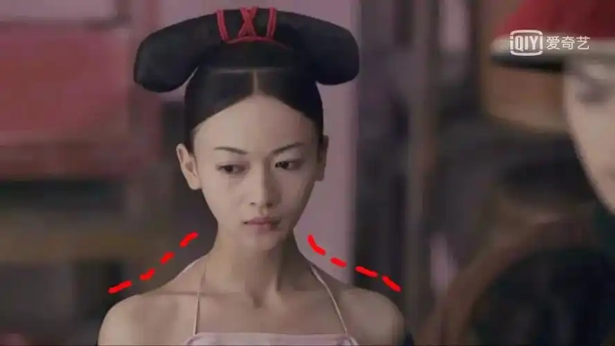 ▽斜方肌过大的首要成因来自长时间不准确的耸肩姿势,好比历久提拿