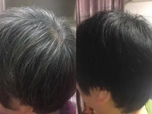 白发变黑了!以色列纯植物染发膏,经常染也很健康