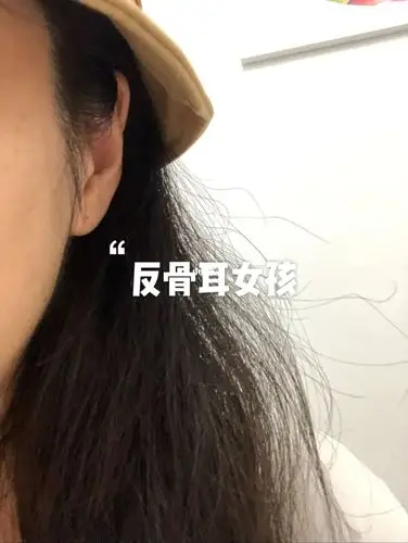 反骨耳有没有同款耳朵的小姐妹