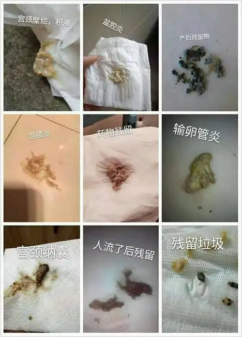 触爱cici私护产品好做吗触爱怎么代理