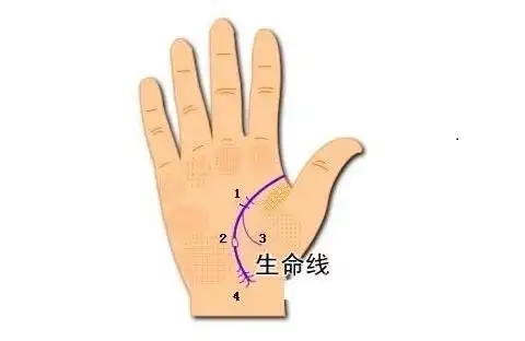 有"两条生命线"就是命硬吗?